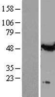 alpha Tubulin (TUBA1A) Human Over-expression Lysates NM_006009