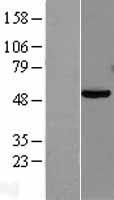PAX8 Human Over-expression Lysates NM_003466