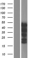 PAX8 Human Over-expression Lysates NM_013952