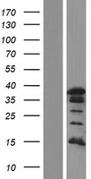 PAX8 Human Over-expression Lysates NM_013953