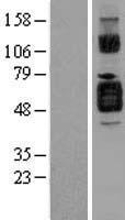 IL1 Receptor II (IL1R2) Human Over-expression Lysates NM_004633
