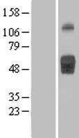IL1 Receptor II (IL1R2) Human Over-expression Lysates NM_173343