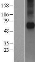 Frizzled 5 (FZD5) Human Over-expression Lysates NM_003468