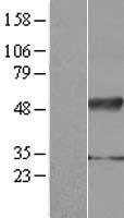 IFRD2 Human Over-expression Lysates NM_006764