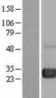 RAB7 (RAB7A) Human Over-expression Lysates NM_004637