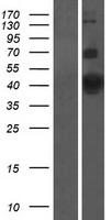 Kv beta 1 (KCNAB1) Human Over-expression Lysates NM_003471