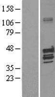 Kv beta 1 (KCNAB1) Human Over-expression Lysates NM_172159