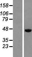 DEK Human Over-expression Lysates NM_003472