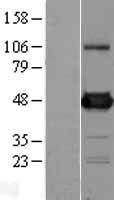 UAP56 (DDX39B) Human Over-expression Lysates NM_004640