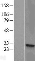 HSD17B8 Human Over-expression Lysates NM_014234