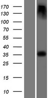 ls007957 epm2a human over expression lysates nm 005670 wb testing 1