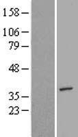ls007965 aimp2 human over expression lysates nm 006303 wb testing 1