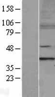 MTERF (MTERF1) Human Over-expression Lysates NM_006980