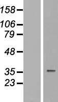 TUSC3 Human Over-expression Lysates NM_006765
