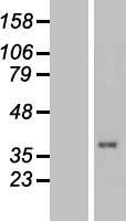TUSC3 Human Over-expression Lysates NM_178234