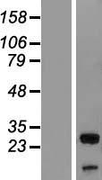 UBXN8 Human Over-expression Lysates NM_005671