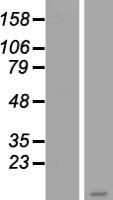PSCA Human Over-expression Lysates NM_005672