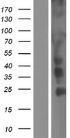CCDC6 Human Over-expression Lysates NM_005436