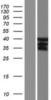 RASSF7 Human Over-expression Lysates NM_001143993