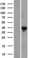 RASSF7 Human Over-expression Lysates NM_003475