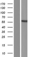 PDHX Human Over-expression Lysates NM_001135024