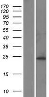 PDHX Human Over-expression Lysates NM_001166158