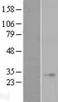 FGF 23 (FGF23) Human Over-expression Lysates NM_020638