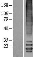 MLF2 Human Over-expression Lysates NM_005439