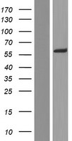ls008086 adracalin aaas human over expression lysates nm 001173466 wb testing 1