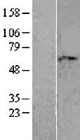 ls008086 adracalin aaas human over expression lysates nm 015665 wb testing 2