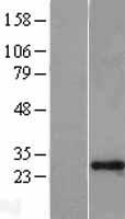 GAS41 (YEATS4) Human Over-expression Lysates NM_006530