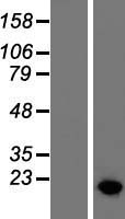HMGA2 Human Over-expression Lysates NM_003484