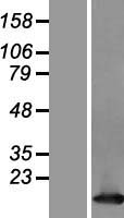 Tcl1 (TCL1A) Human Over-expression Lysates NM_021966