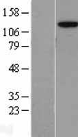 ls008120 ap3b2 human over expression lysates nm 004644 wb testing 1
