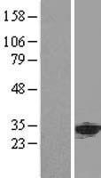 ls008125 phap1 anp32a human over expression lysates nm 006305 wb testing 1