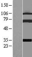 Coilin (COIL) Human Over-expression Lysates NM_004645