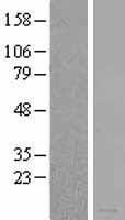 Melanoma Inhibitory Activity (MIA) Human Over-expression Lysates NM_006533