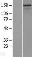 ls008202 src3 ncoa3 human over expression lysates nm 006534 wb testing 1