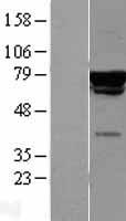 p60 CAF1 (CHAF1B) Human Over-expression Lysates NM_005441