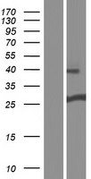 DGCR6 Human Over-expression Lysates NM_005675