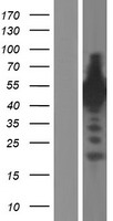Synapsin III (SYN3) Human Over-expression Lysates NM_133633