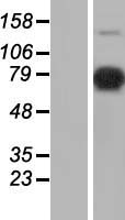 SFRS17A (AKAP17A) Human Over-expression Lysates NM_005088