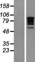 RBM10 Human Over-expression Lysates NM_152856