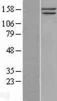 ls008243 smc1 smc1a human over expression lysates nm 006306 wb testing 1