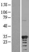ARD1A (NAA10) Human Over-expression Lysates NM_003491