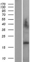 ls008270 lage3 human over expression lysates nm 006014 wb testing 1