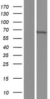 TKTL1 Human Over-expression Lysates NM_001145933
