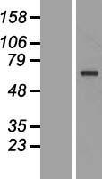 TKTL1 Human Over-expression Lysates NM_012253