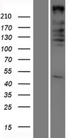 ARID1A Human Over-expression Lysates NM_006015