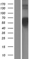 COLQ Human Over-expression Lysates NM_080538
